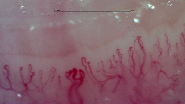 Several rounded loops grouped in the center, with simple hairpin capillaries on the left and tortuous capillaries on the right.
