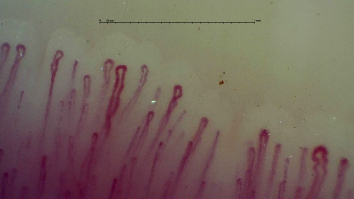 Long hairpin capillaries of different widths, with mild bends and a small oval crossed loop at the right edge.