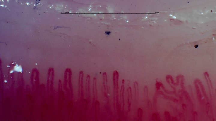 Several closely spaced curved loops at the lower right, beside simpler upright hairpin capillaries.