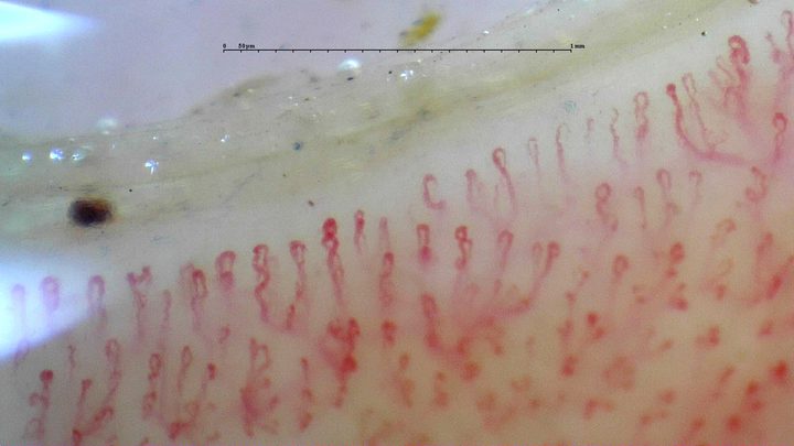 Fine hairpin capillaries with small coiled apices and possible accessory loops. Shorter vessels are visible in the deeper plane.