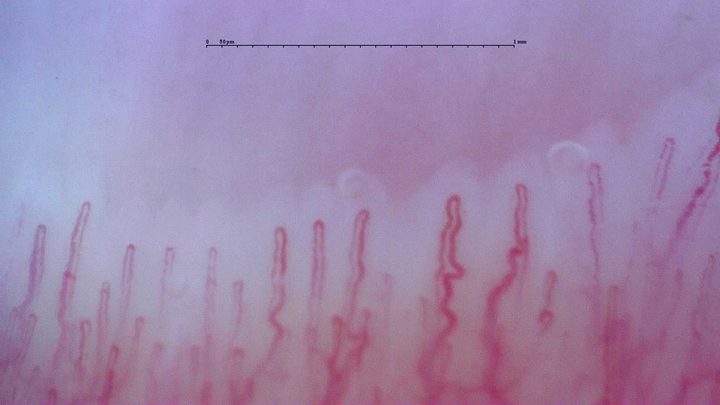 Slender capillaries with rounded apices and mildly tortuous limbs, especially right of center.