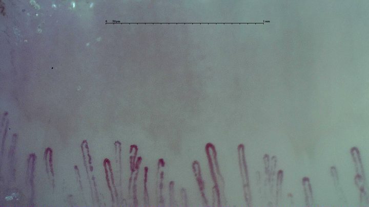 Short hairpin capillaries with rounded apices and variable widths.