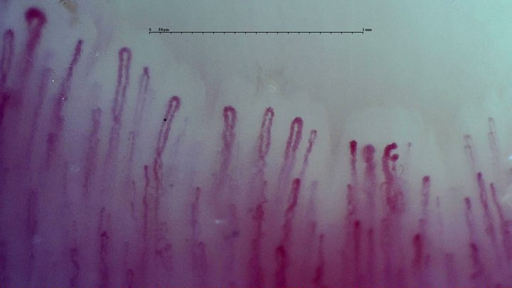 An enlarged rounded apex at the upper left, beside long narrow hairpin capillaries.