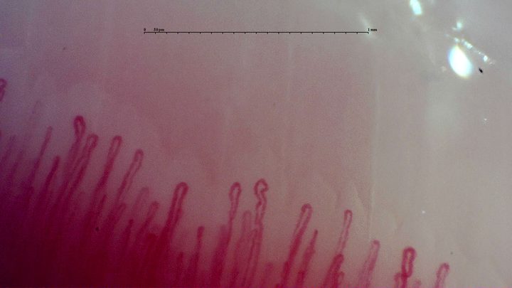 A small S-shaped capillary near the center, beside taller open hairpin loops.
