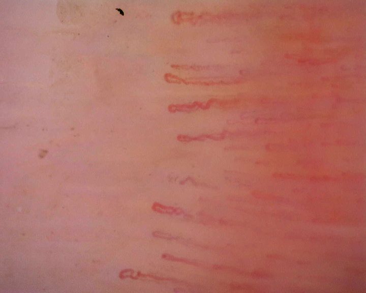 Slender capillaries with repeated small twists and bends in their limbs.