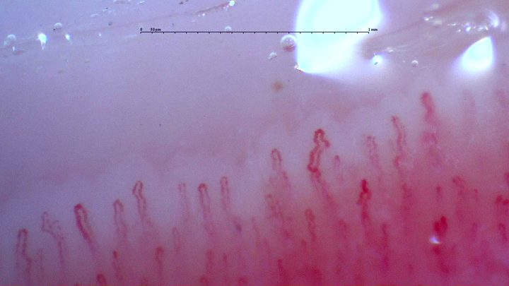 A capillary right of center has several angular bends, with smaller twists in neighboring hairpin loops.