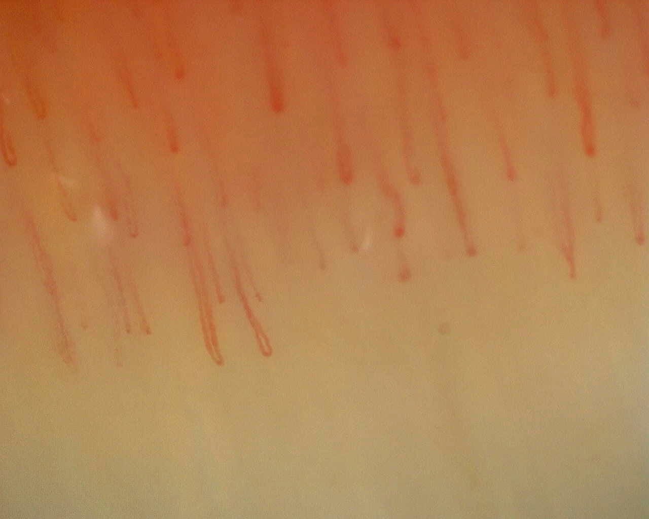 Capilaroscopia periungueal: anular derecho, campo c. Patrón inespecífico: caso representativo.