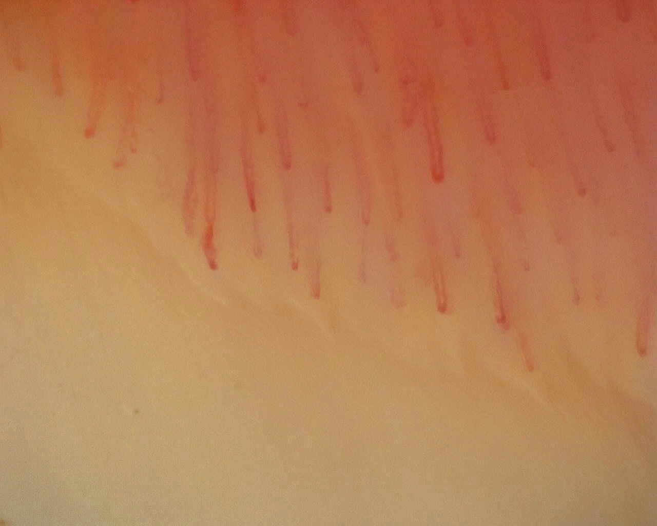 Capilaroscopia periungueal: anular izquierdo, campo d. Patrón inespecífico: caso representativo.