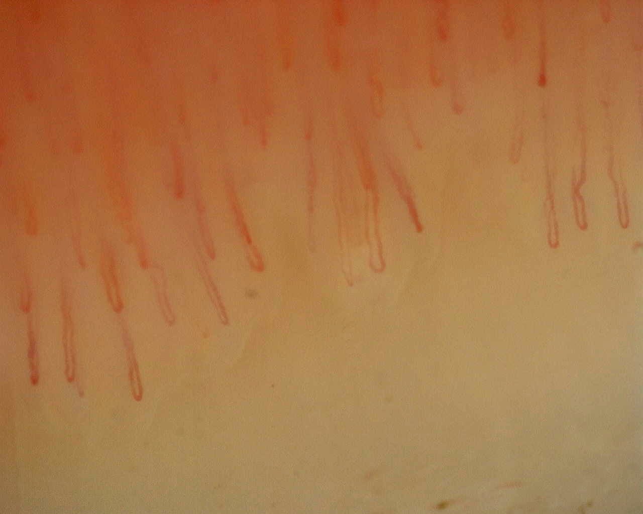 Imagen de vista previa de Patrón inespecífico: caso representativo