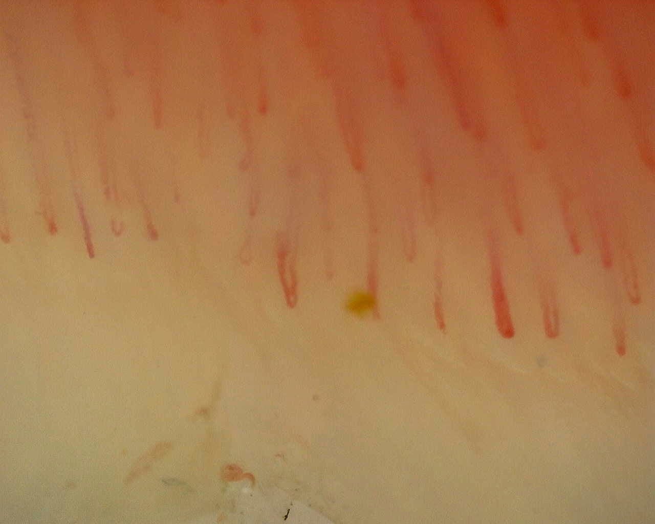 Capilaroscopia periungueal: anular derecho, campo a. Patrón inespecífico: caso representativo.