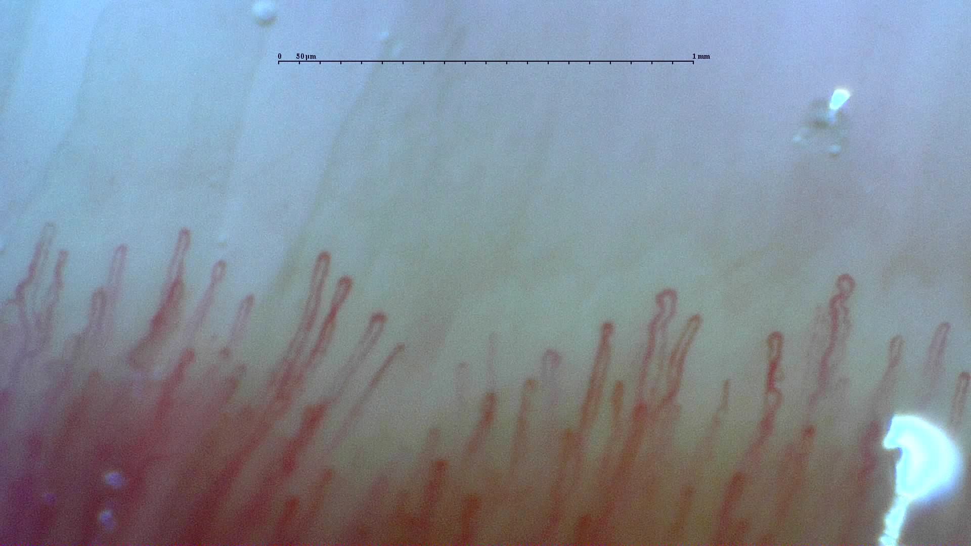 Imagen de vista previa de Patrón normal: caso representativo