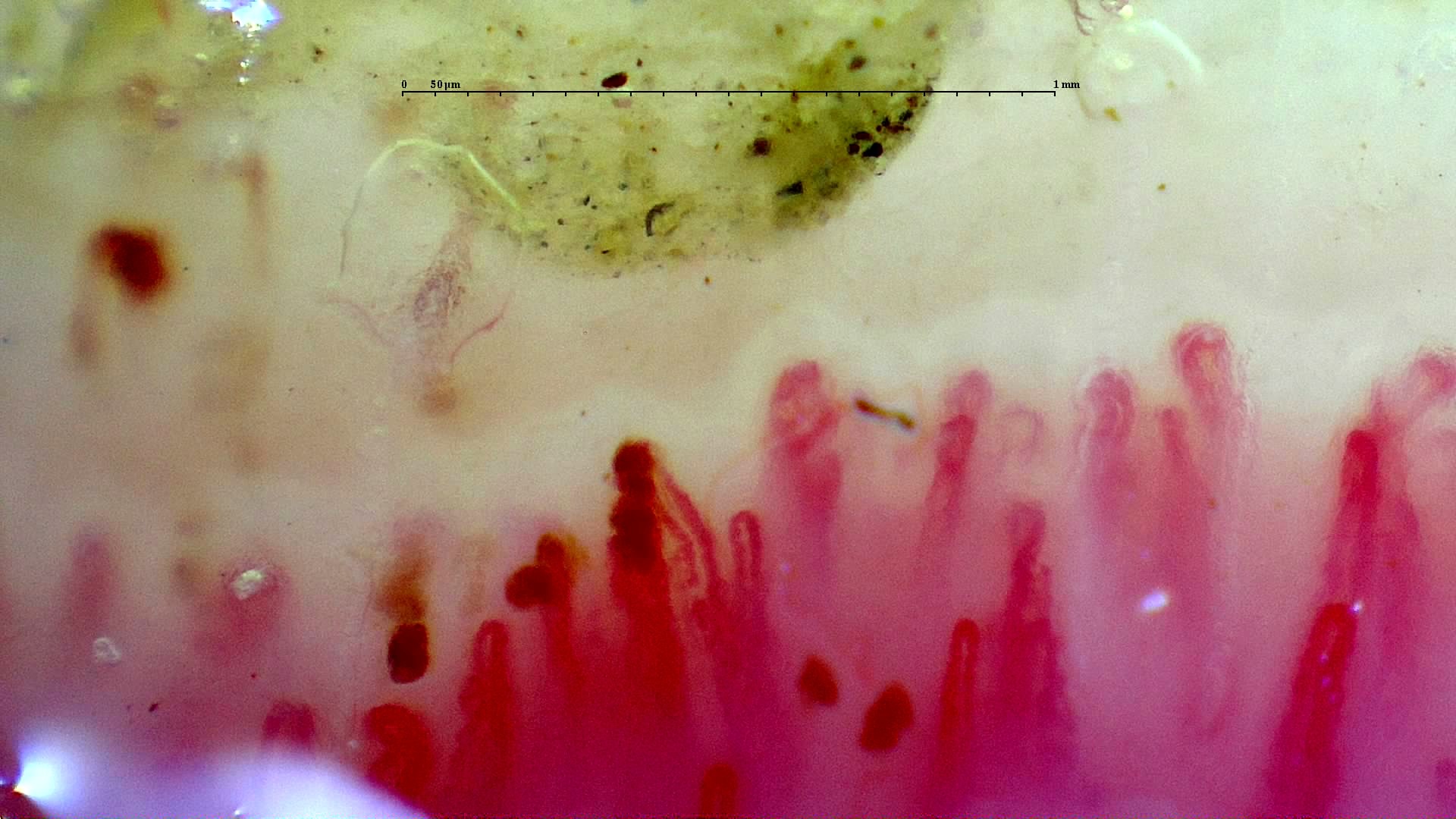 Imagen de vista previa de Cutolo activo en SSc: caso representativo