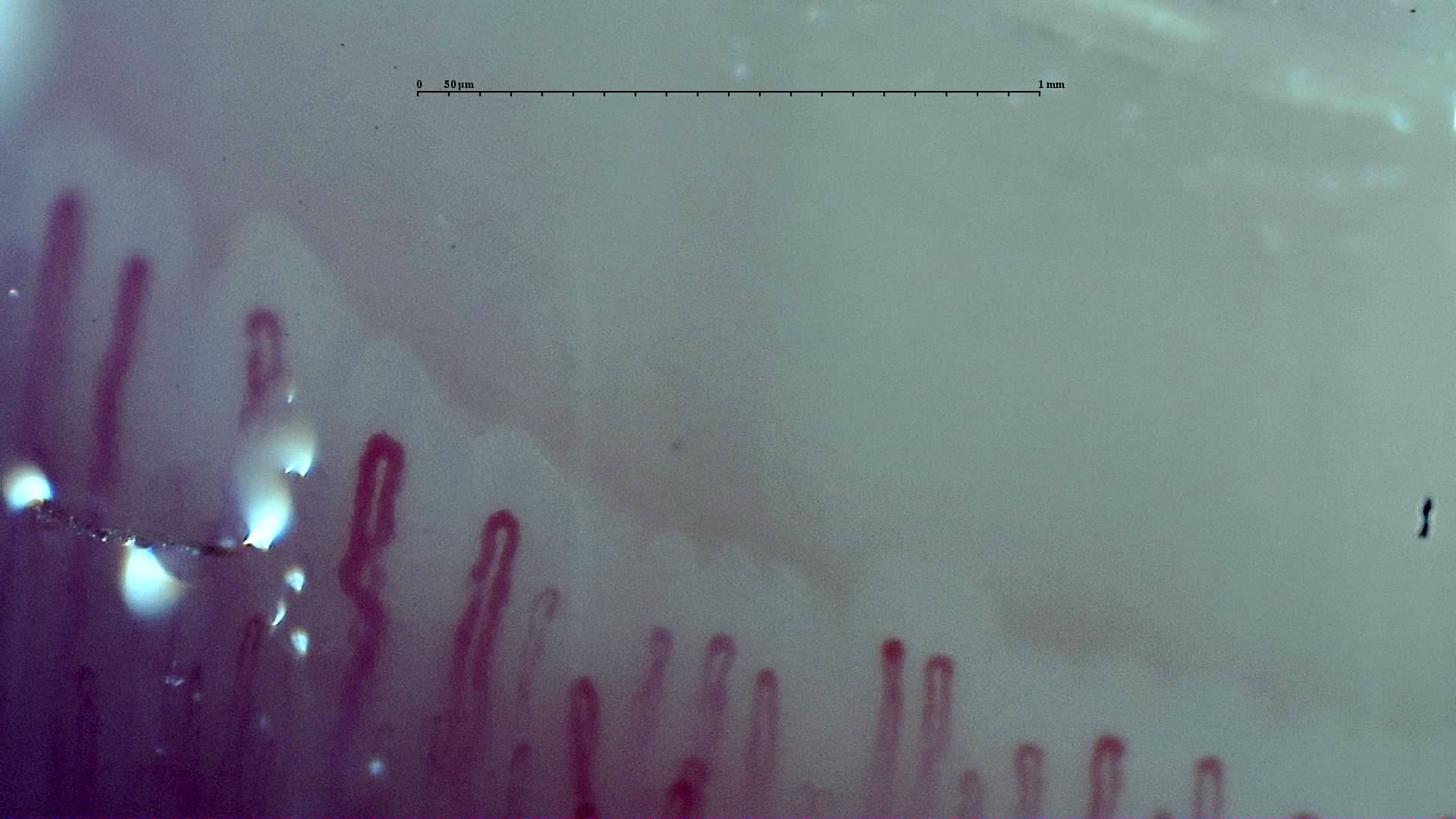 Imagen de vista previa de Cutolo temprano en SSc: caso representativo