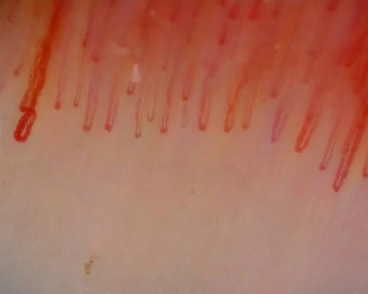 Elongated hairpin capillaries, with wider apices at the sides and finer loops in the center.