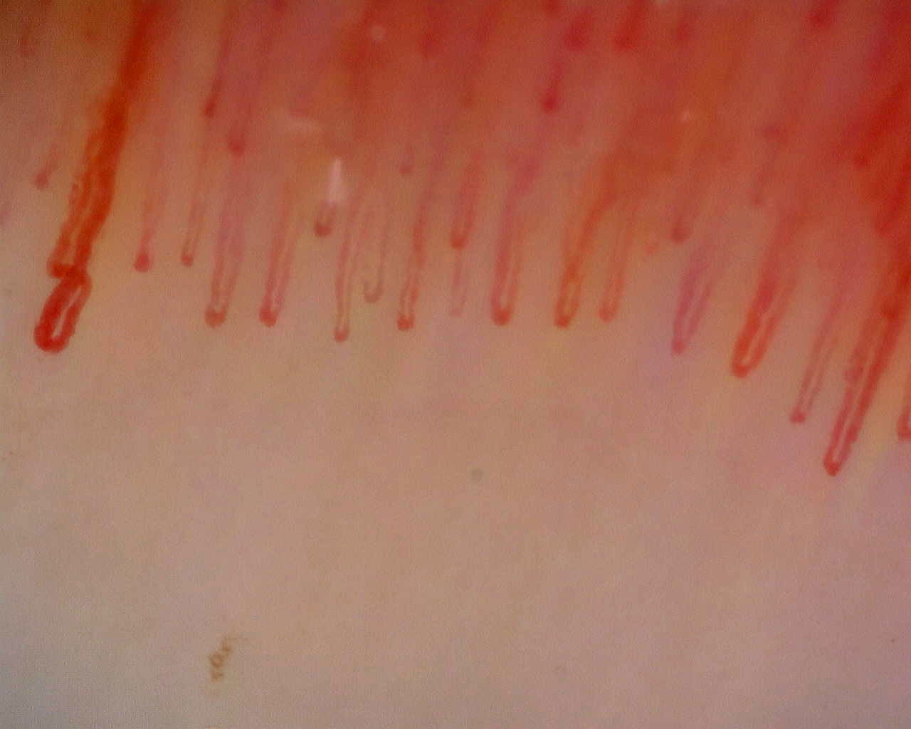 Capilares alargados en horquilla, con ápices más anchos en los extremos y asas más finas en el centro.