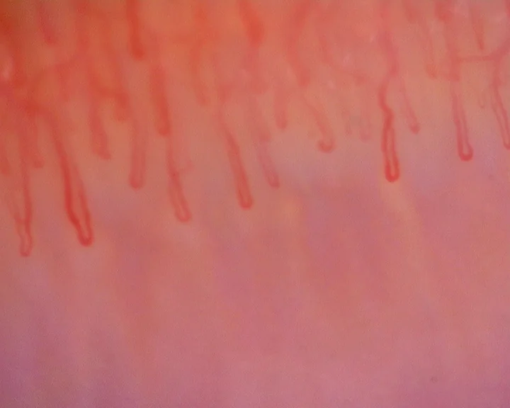 Long hairpin capillaries with parallel limbs. The loop on the left is wider than the others.