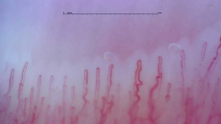 Slender capillaries with rounded apices and mildly tortuous limbs, especially right of center.