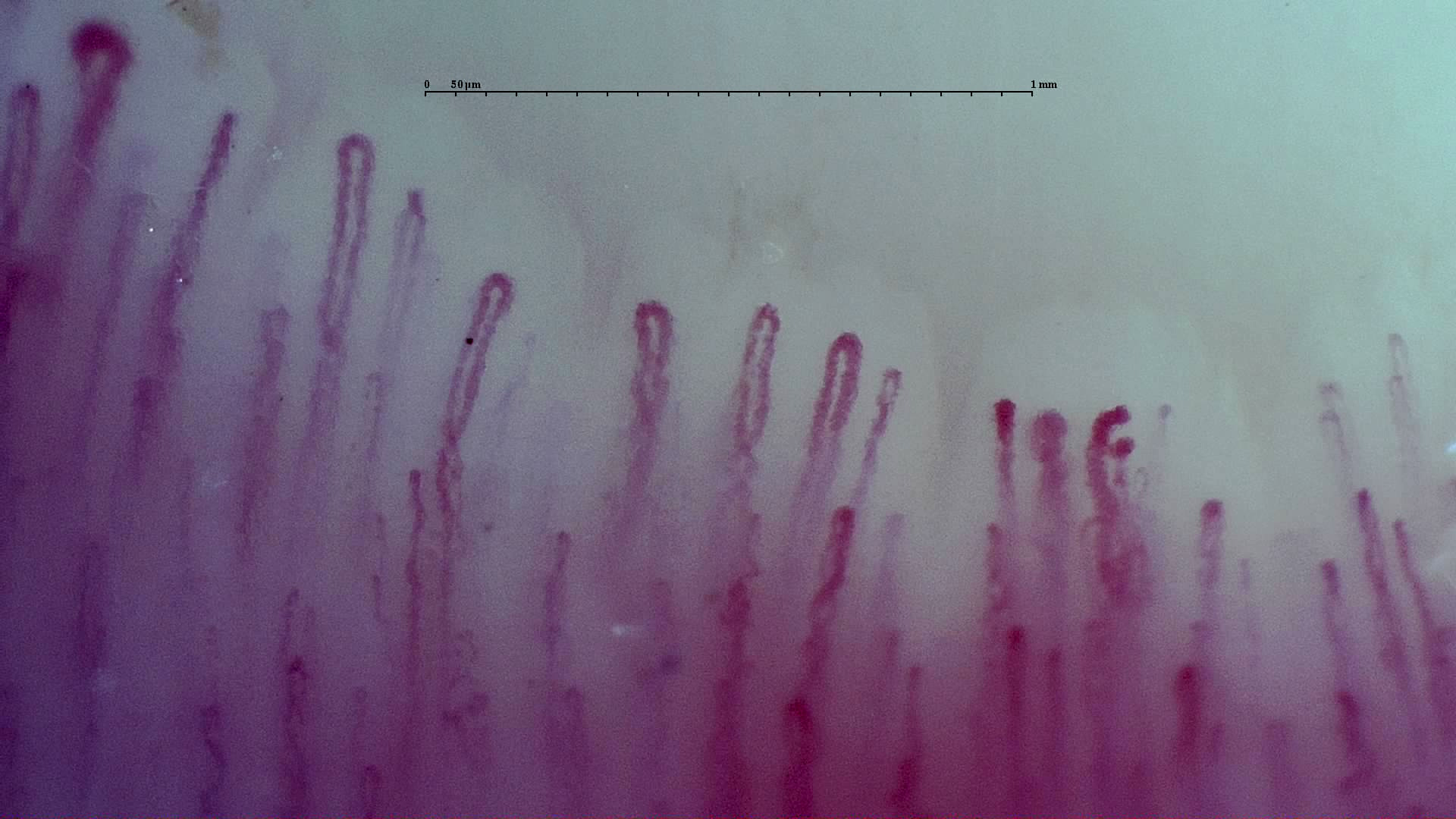 An enlarged rounded apex at the upper left, beside long narrow hairpin capillaries.