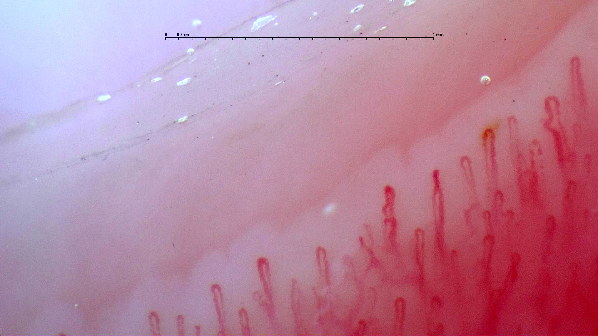 Capilares finos con torsiones leves cerca de algunos ápices derechos. Las asas de la izquierda son horquillas más simples.